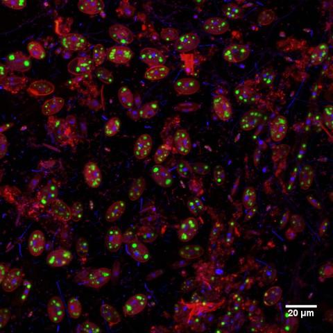 Visualization Method Provides Quantitative Number for Biomass -- First Estimate of its Kind