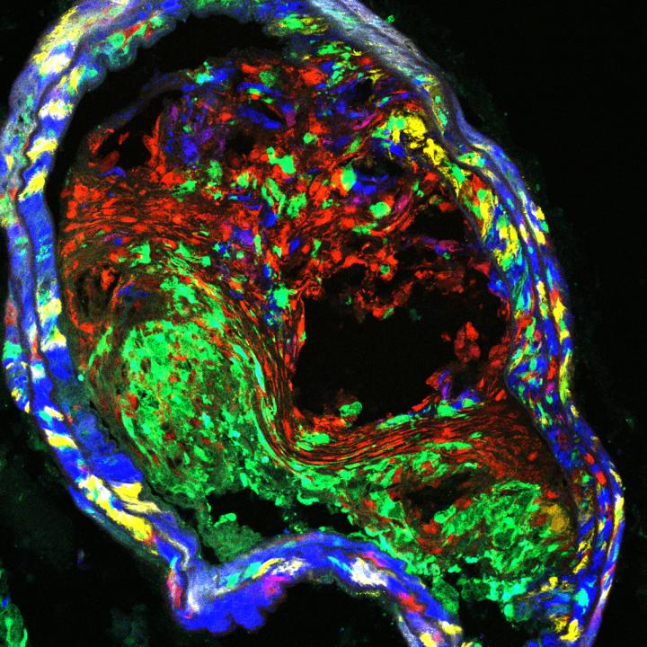 Cross-section of advanced plaque from a diseased mouse blood vessel