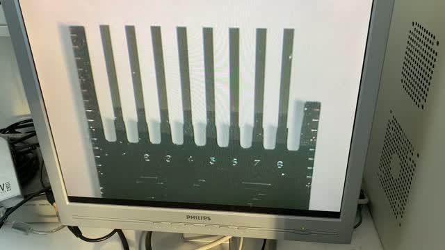 Detection of antibiotic resistance using a cantilever array