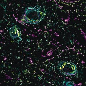 Medulla region of human thymus