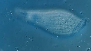 Microscopic Life - Apertospathula