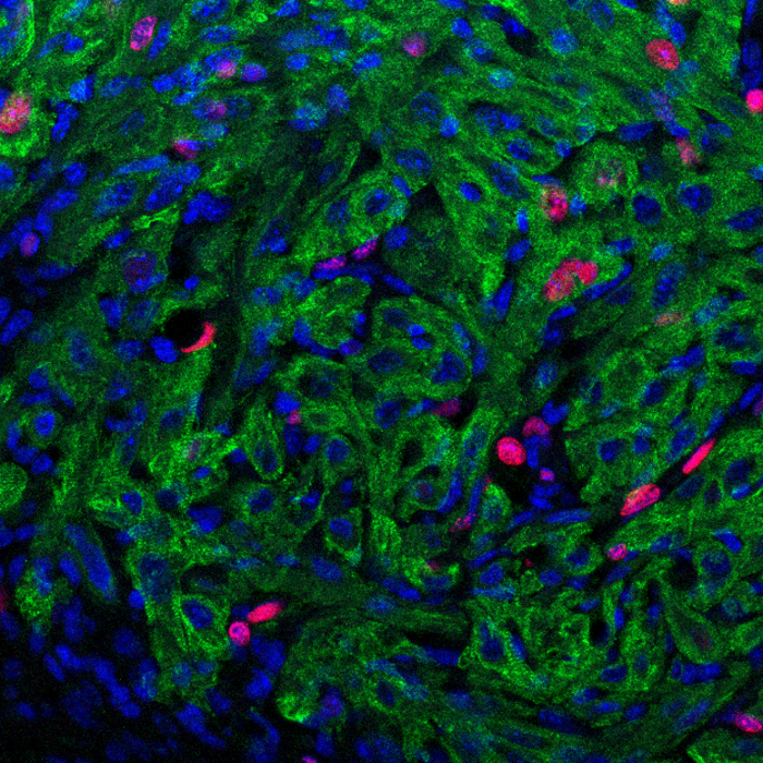 New Texas Heart Institute Study Outlines Additional Reasons for Optimism Related to Heart Regeneration