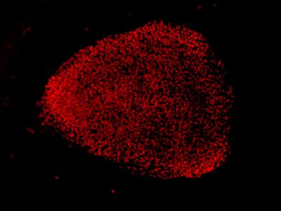 Patient-derived Stem Cells