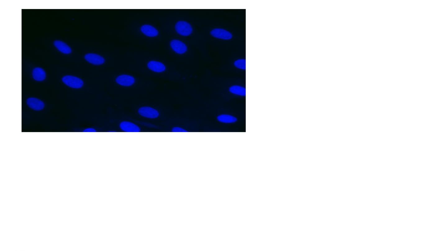 DM1 Cells Kinase Inhibitor Treated 2