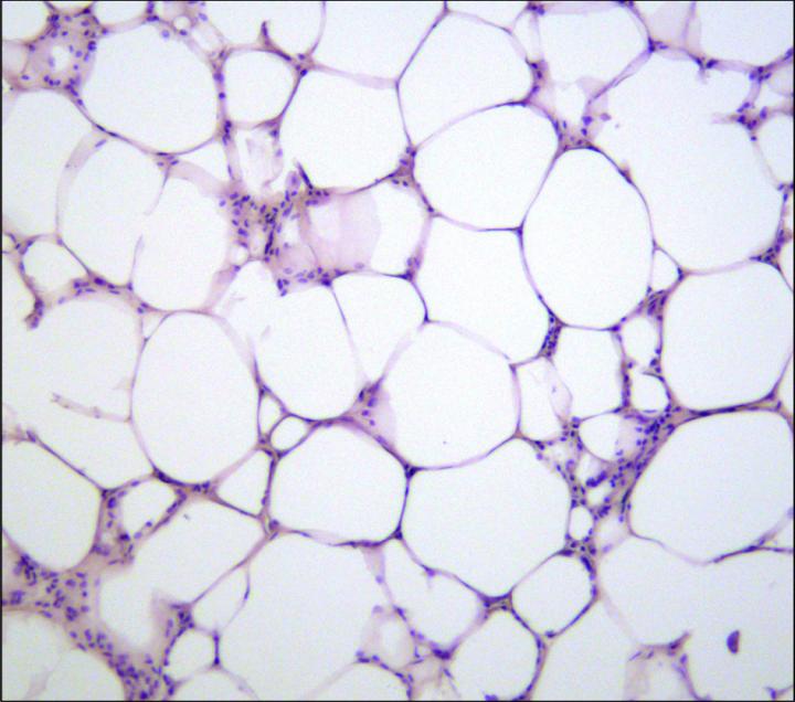 Fat Tissue with Elevated SORLA Levels