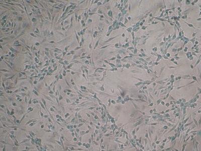 No Apoptosis Induced