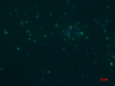 Archaea -- An Overlooked Source of Greenhouse Gas