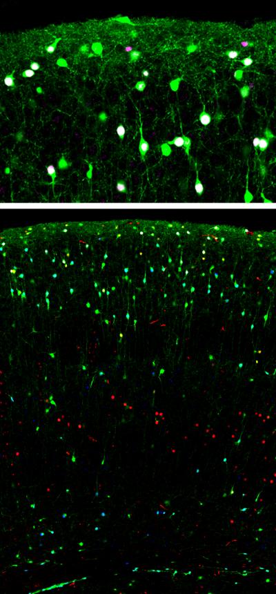 Inhibitory Interneurons