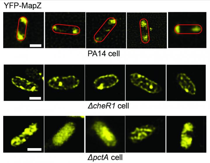 Blocking Bacterial Protein May Combat Drug-Resistant Biofilms (2 of 3)