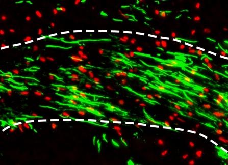 New Gene Enhances Myelin Formation