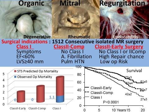 Early Surgery for Mitral Regurgitation, Before Clinical Triggers Emerge, Has Best Outcomes