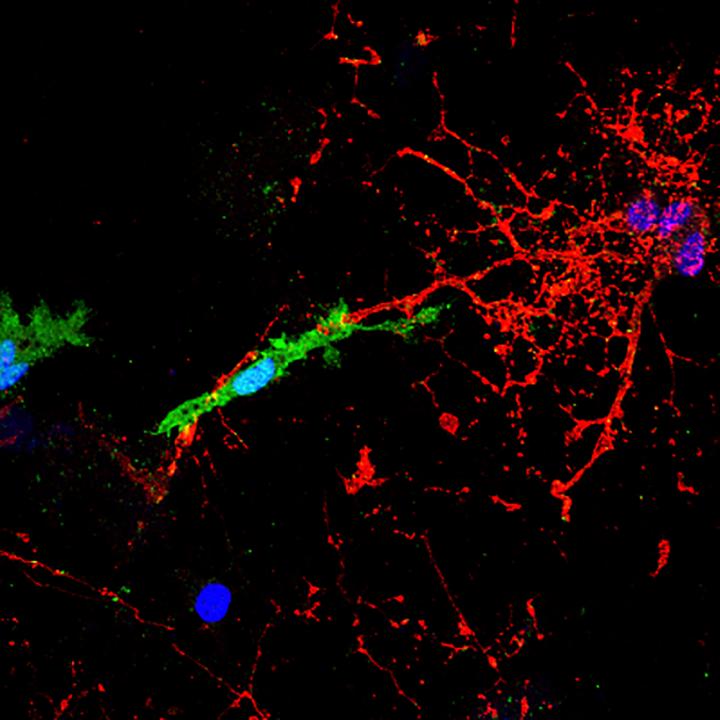Microglial Cell Attacks Myelinated Axon