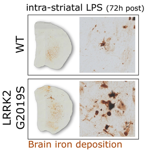 Parkinson’s disease mutation misdirects iron in the brain