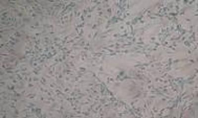 No Apoptosis Was Induced