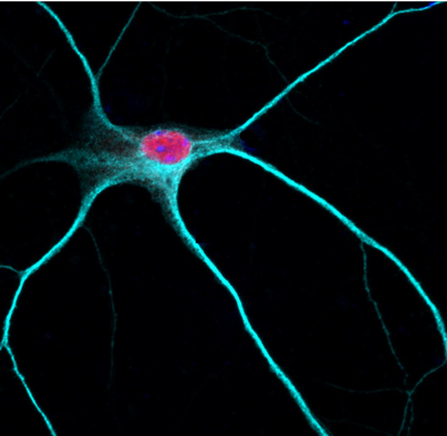 Rbfox1 in the Nucleus