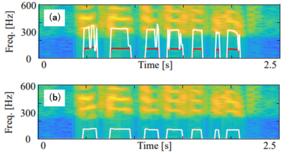 Pitch estimation results for call audio