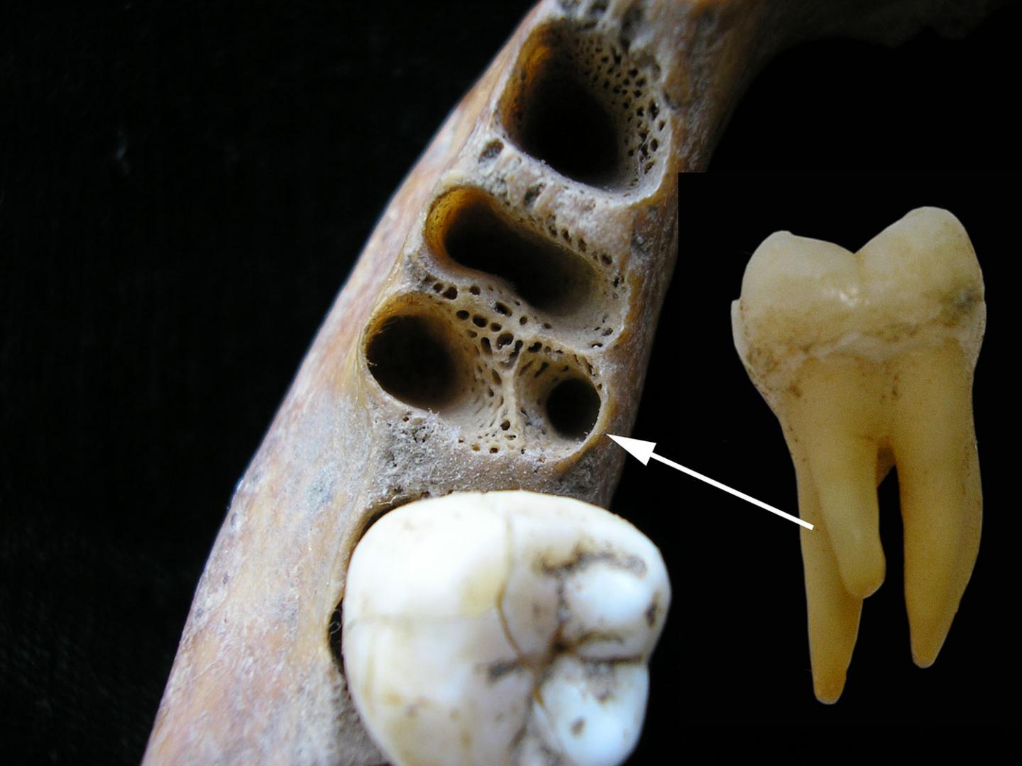 Jaw and Tooth