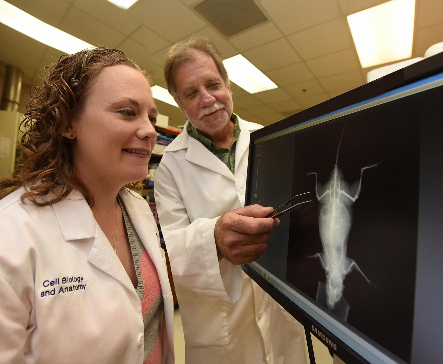 Tears in Tiny Bone Cells Called Osteocytes Appear an Important Step to Better Bones