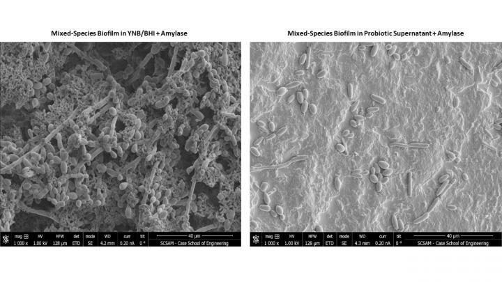 Mixed-Species Biofilm