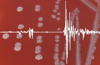 Metabolic Fingerprint in Bacteria