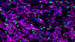 Mouse Pancreatic Tissue