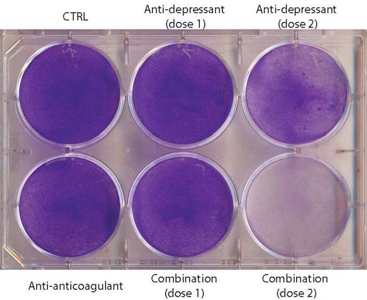 Glioblastoma Cell Response to Combination Antidepressant and Anticoaguant