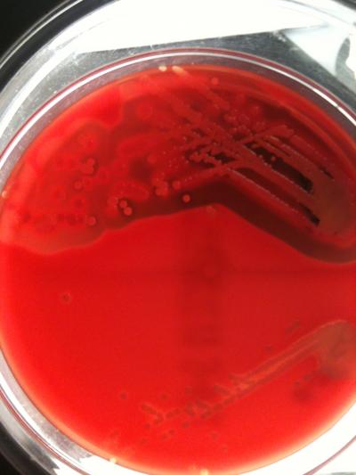 A Petri Dish of MRSA