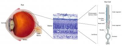 Roadmap for Inherited Eye Diseases