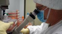 Examining Vero Cells for the Zika virus