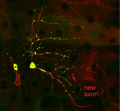Key Protein Discovered That Allows Nerve Cells to Repair Themselves (1 of 2)