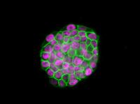 Colony of iPS Cells (2 of 3)
