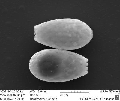 A Testate Amoeba's Shell (<I>Euglypha</I>)
