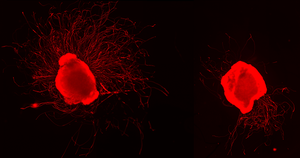 Nerve cell growth