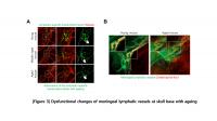 Figure 3: Structural and Functional Impairment of Basal Meningeal Lymphatic Vessels with Ageing