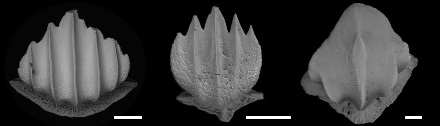 Scanning electron microscope images of denticles