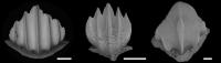 Scanning electron microscope images of denticles