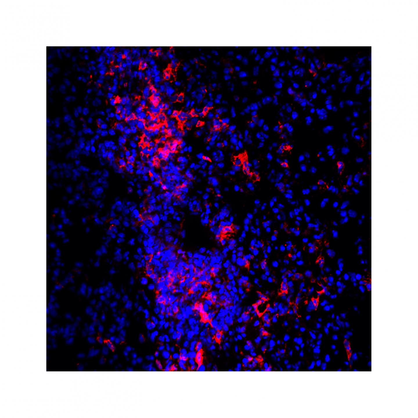 Macrophages in the Lungs (Mouse Tissues) after Influenza Infection