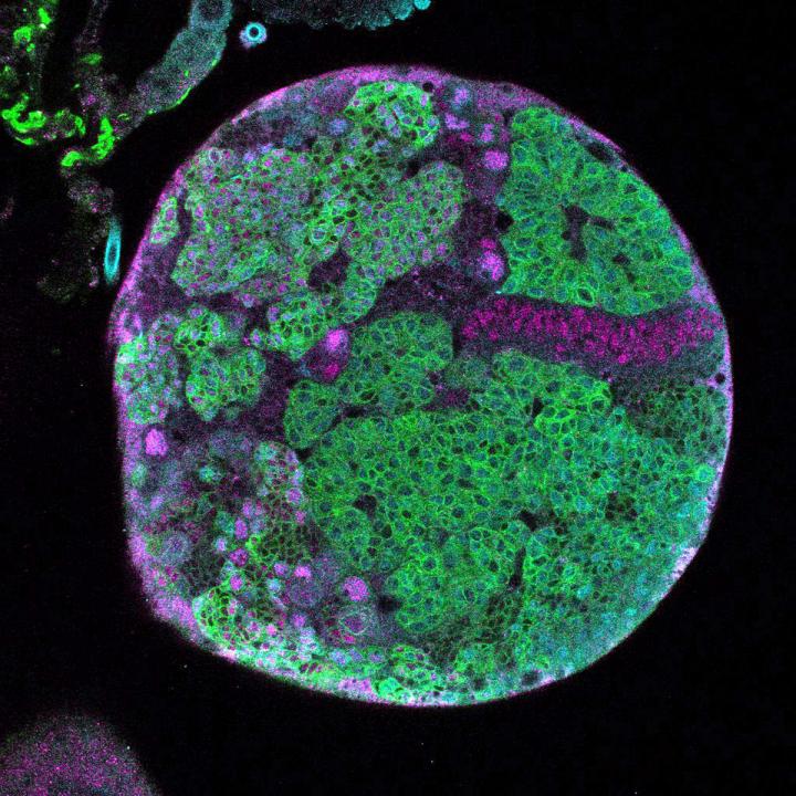 Notch Signaling, Minus Eyeless, Builds Tumors