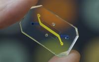 Organs-on-Chips
