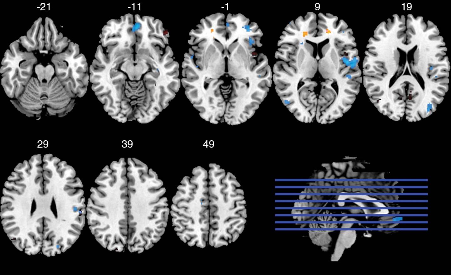 Image 2 Axial functional MRIs