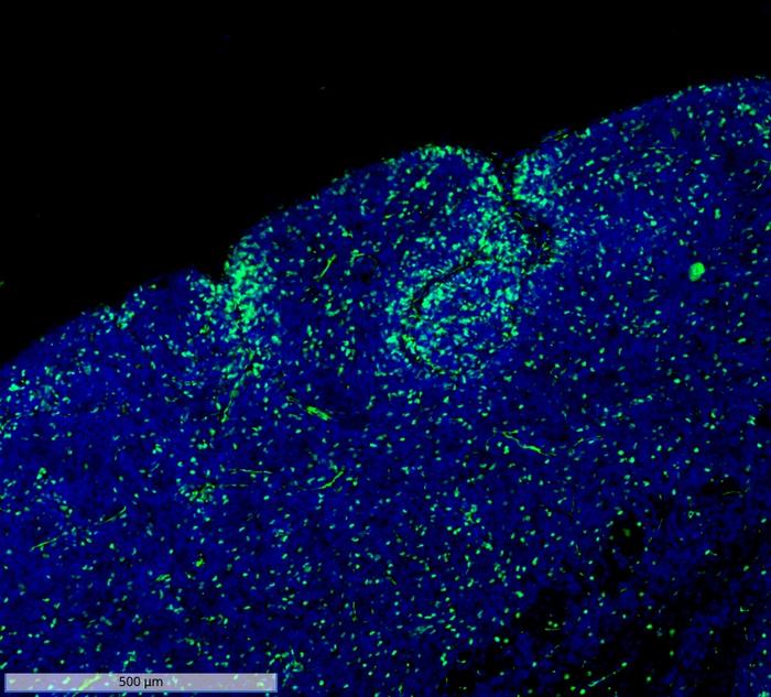 Figure 1: Transcription factor OLIG2 as a targetable regulator of stemness