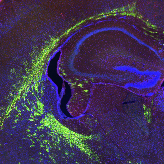 The developing preclinical model’s brain with myelinated axons (shown in green color)