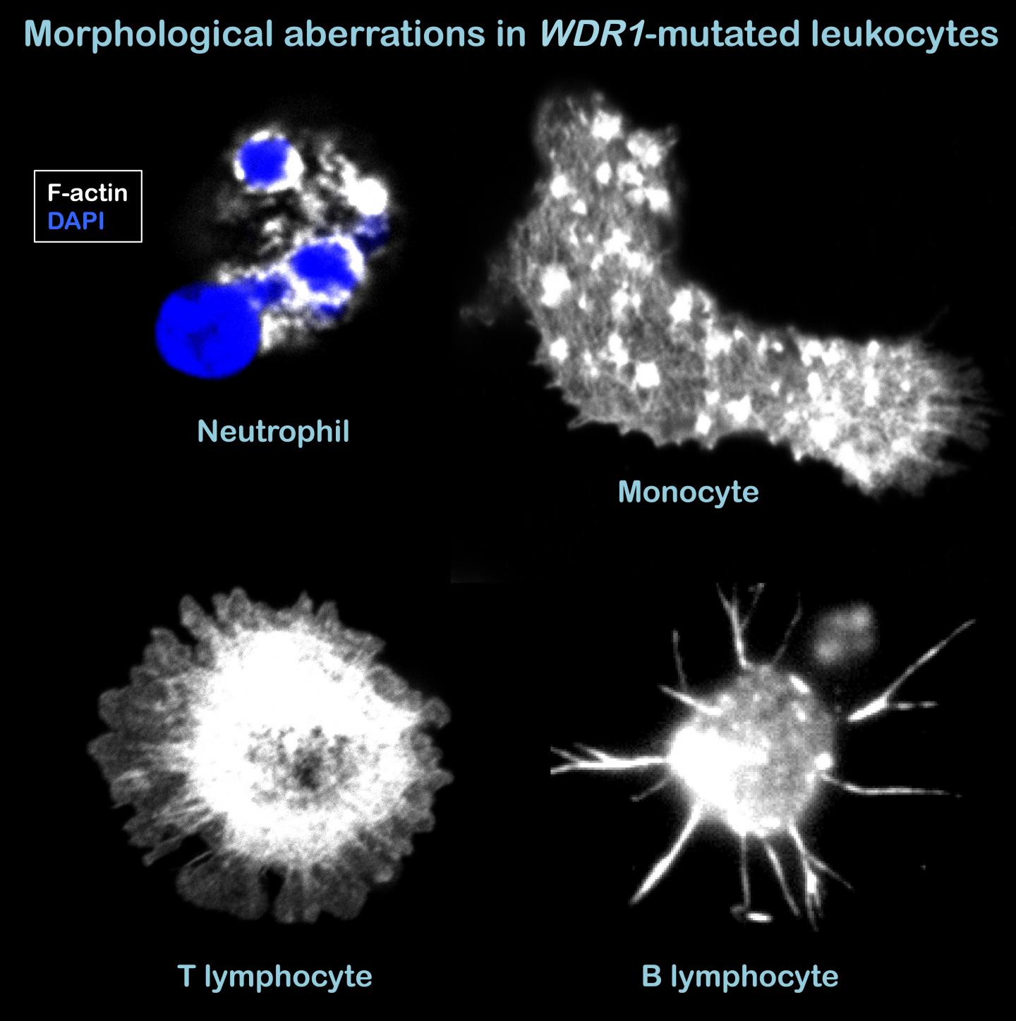 Mutations Affecting the Actin Regulator WDR1 Lead to Aberrant Lymphoid Immunity