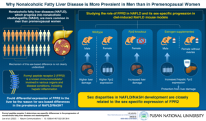 Pusan National University Scientists Discover Why Women Are More Resistant to Nonalcoholic Fatty Liver Disease than Men