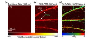 Image comparison of the in vivo results of Traditional-PAM and SLD-PAM