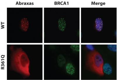 New Member of the Breast-Cancer Gene Network