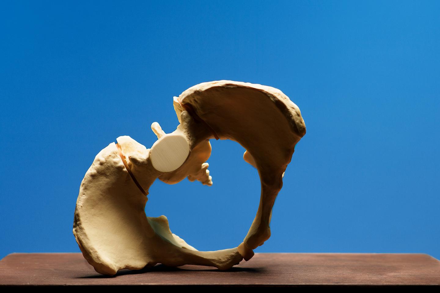 Pelvis Model