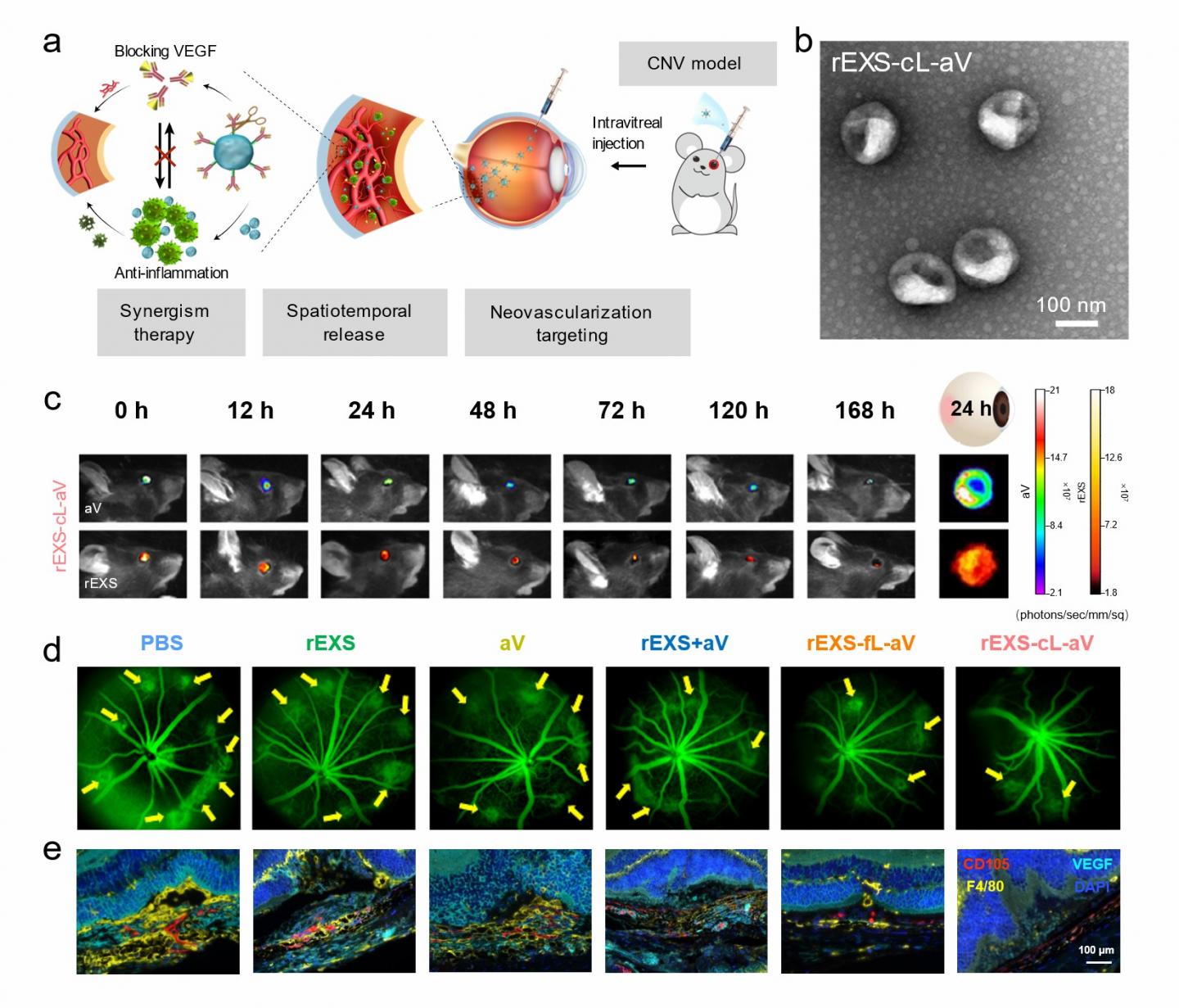 Regulatory T-cell exosome-based formulation to deliver VEGF antibodies for synergistic therapy in CNV mouse model