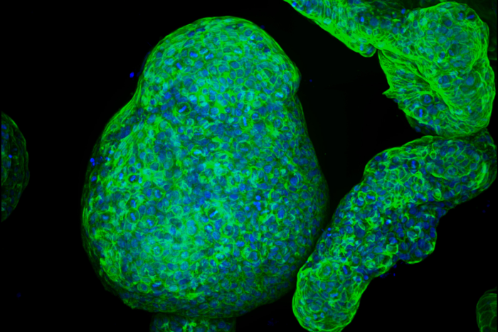 Pancreatic Organoids