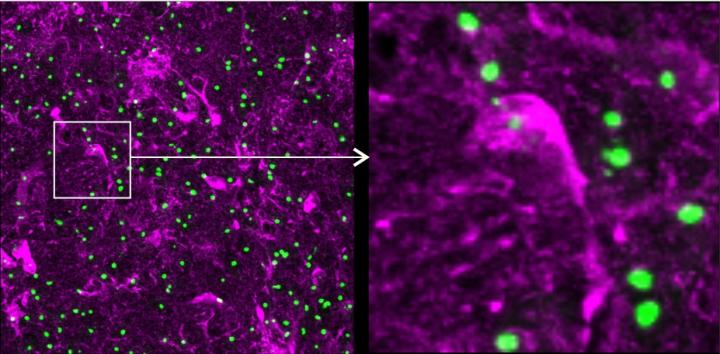 Astrocytes with Mutant Huntingtin Protein Inclusions